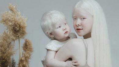 Photo of Le meravigliose sorelle albine ci insegnano che la bellezza può esistere in mille modi diversi