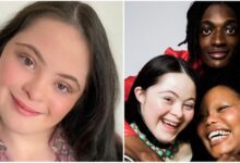 Photo of Ellie Goldstein,  la prima modella con la sindrome di Down a posare per Gucci. E addio ai preconcetti